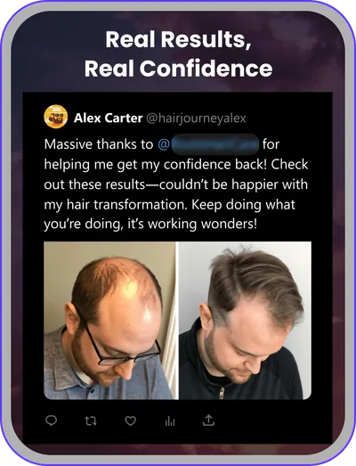 Ad design: hair loss treatment with a before-and-after customer post
